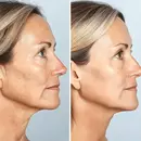 vitamin c serum, levaye cosmetics