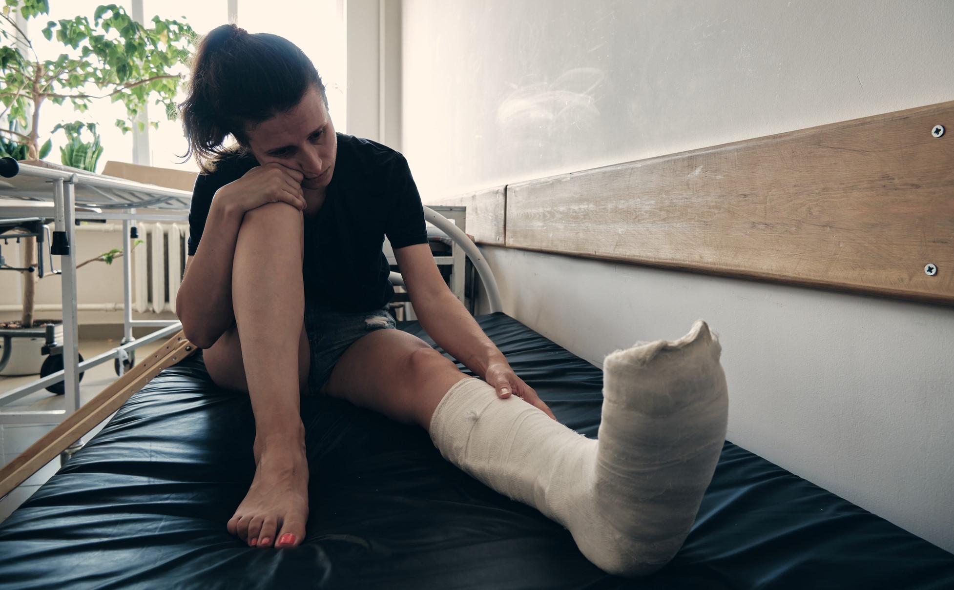 broken ankle being in a cast