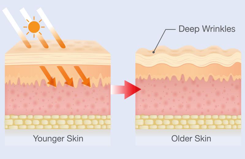 UV exposure to skin
