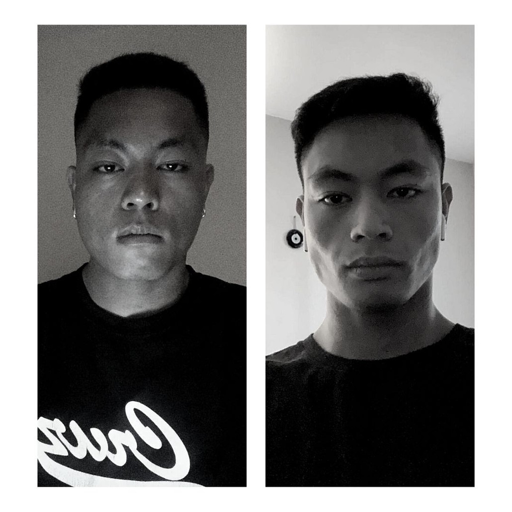 Jawliner avant et après