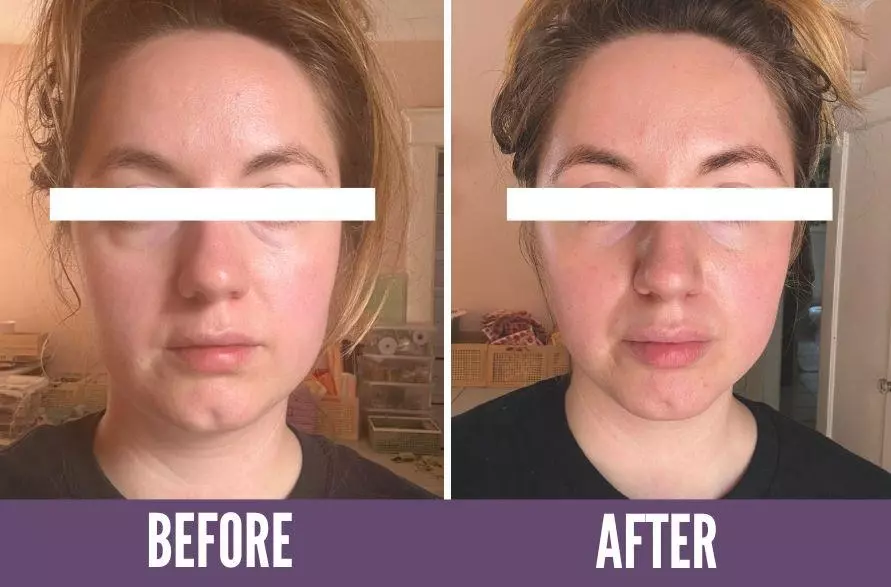 Before and after photos of a woman showing results from face yoga.