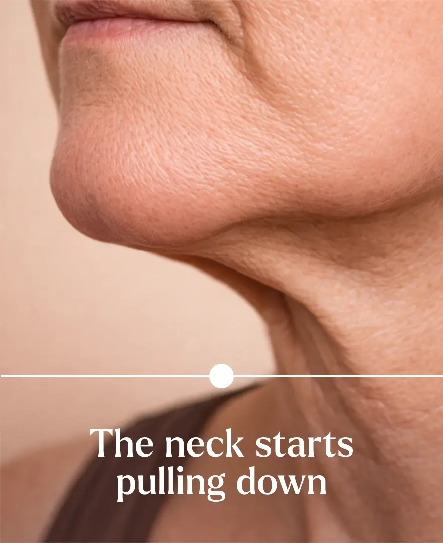 Women showing neck starts pulling down