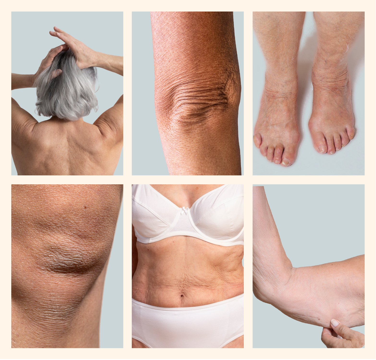 Mature, dry, sagging, and crepey looking skin