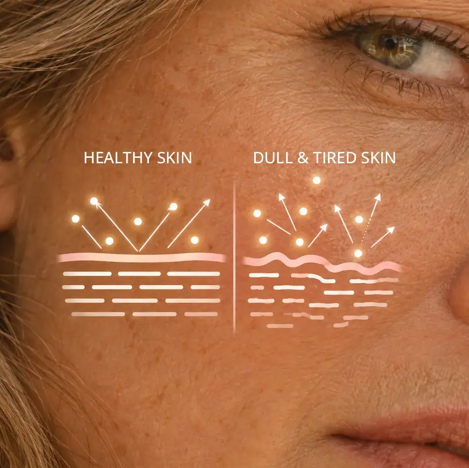Skin is leaking light