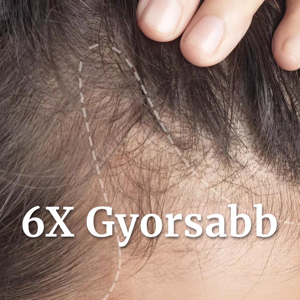 Scalp aging