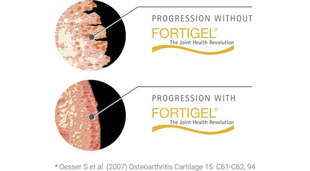 Fortigel, a patented ingredient in Collagen synthesis, is a science-backed solution for joint healing and recovery
