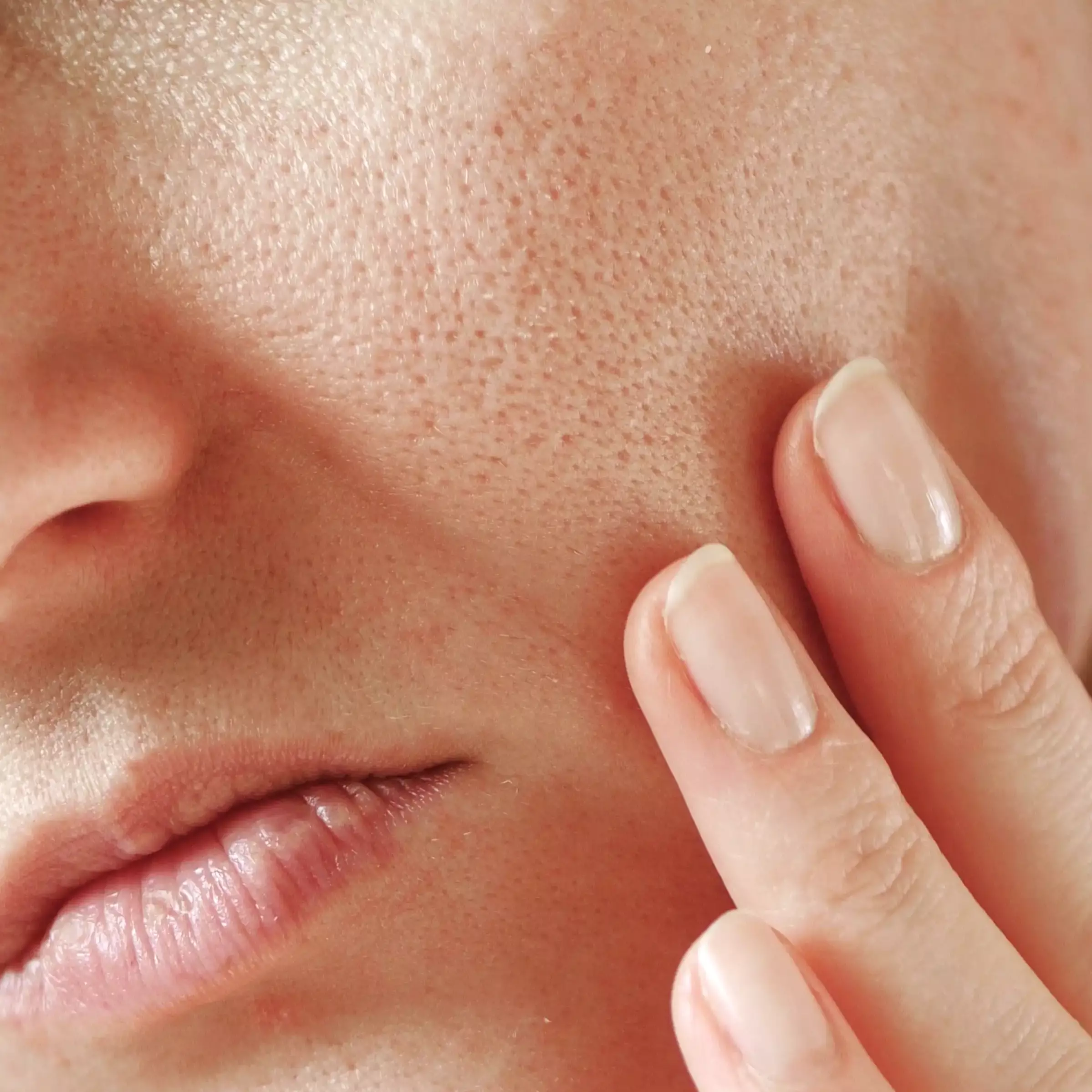 who has dry skin but doesn’t do too well with oils 