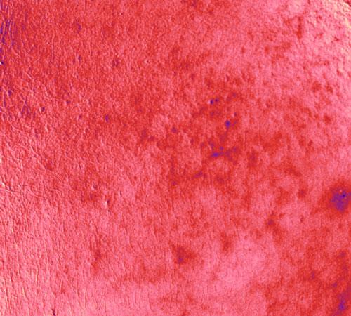 Redness in participant on day 1