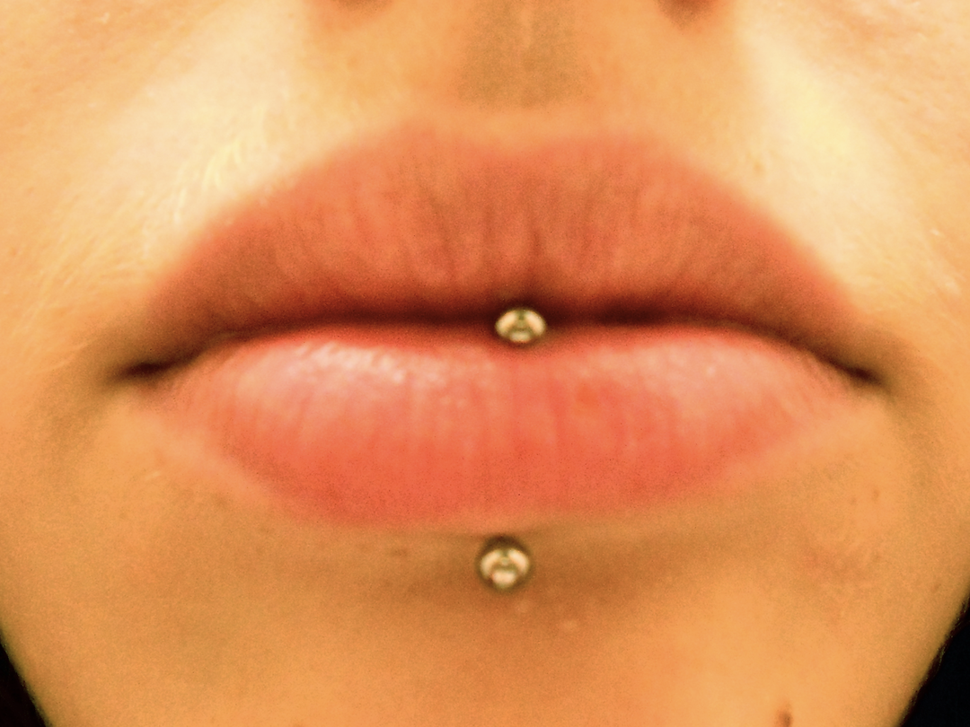 horizontal lip piercing scar