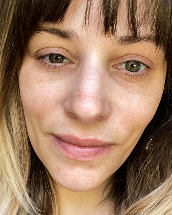 After photo of Jessica, one month after using Clearizy, with smoother, clearer skin.