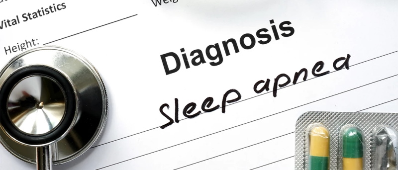 Diagnosis Sleep apnea