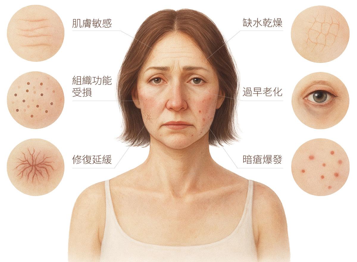 一位中年女性，臉上有明顯皮膚問題，周圍附有標示的特寫，突出皮膚敏感、缺水、組織功能受損、早衰、修復延遲及爆痘等症狀。
