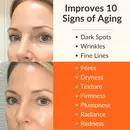 Levaye vitamin c serum