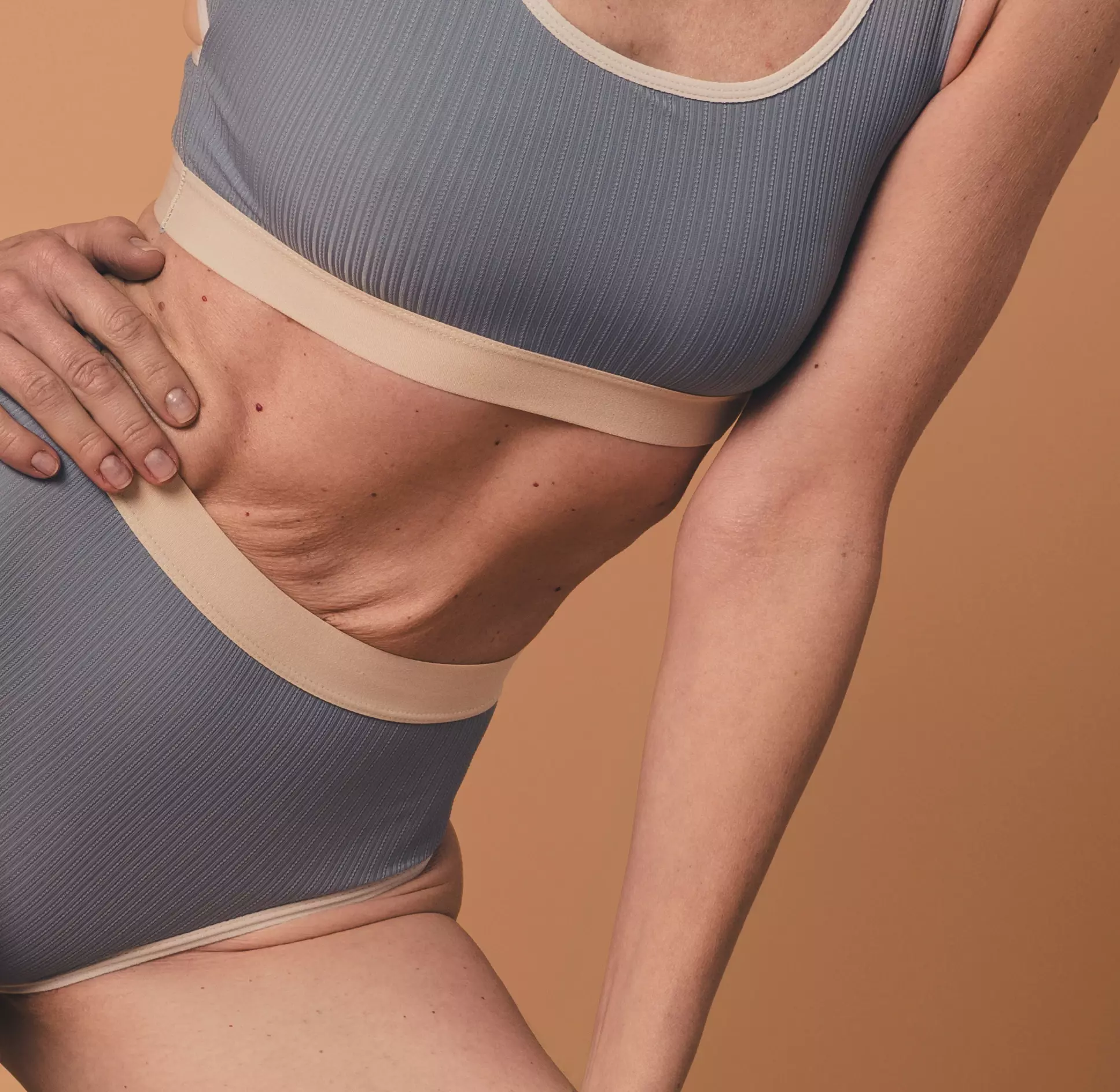 Saagy skin after weight loss 2