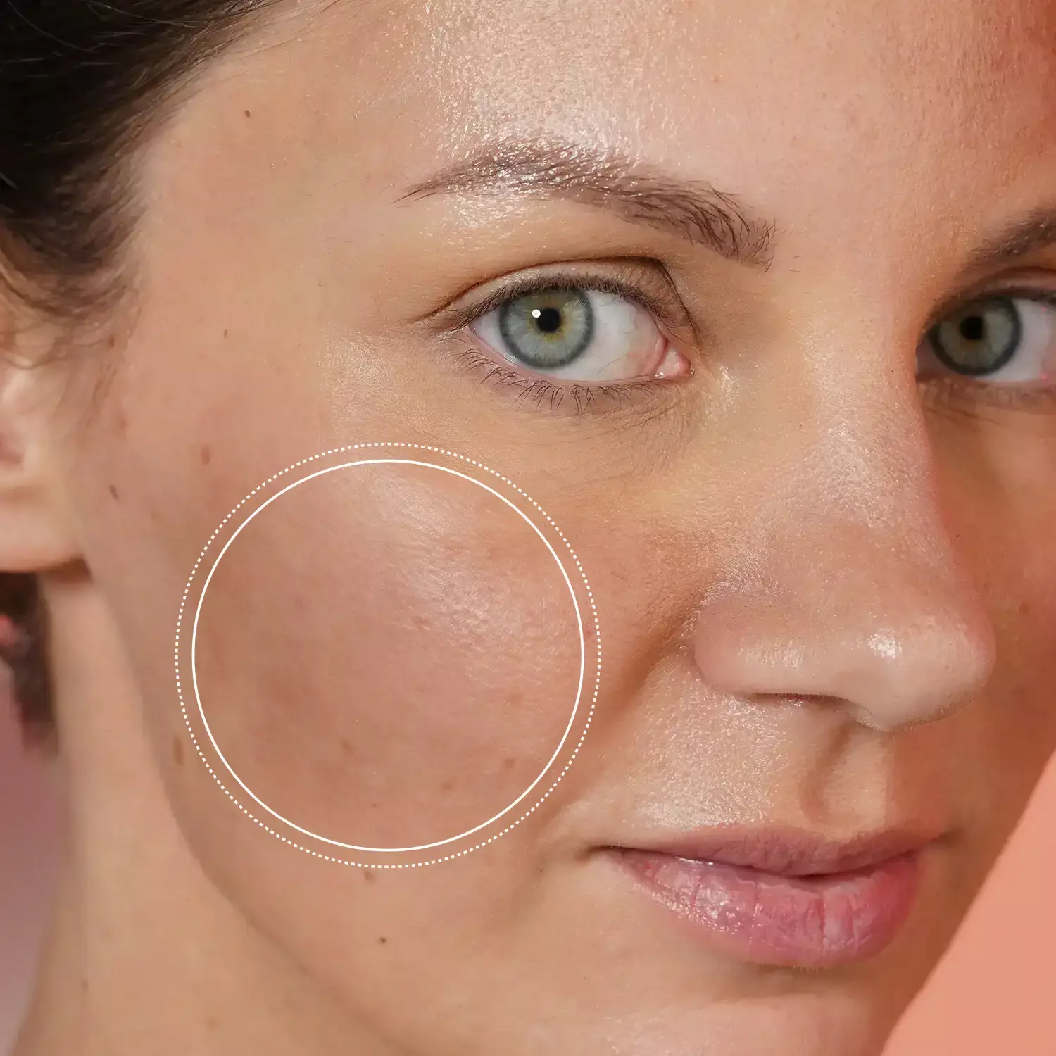face close up with dark spots