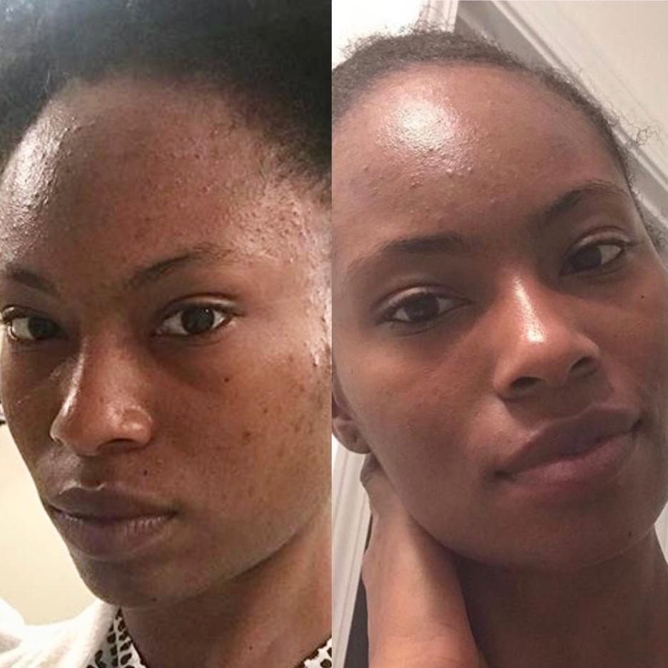 Bloom Beautifully 20 Vitamin C Super Serum Apple Rose Beauty