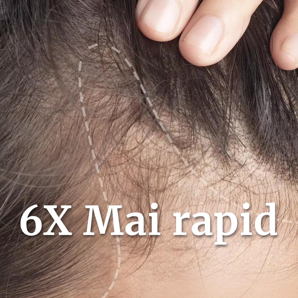 Scalp aging