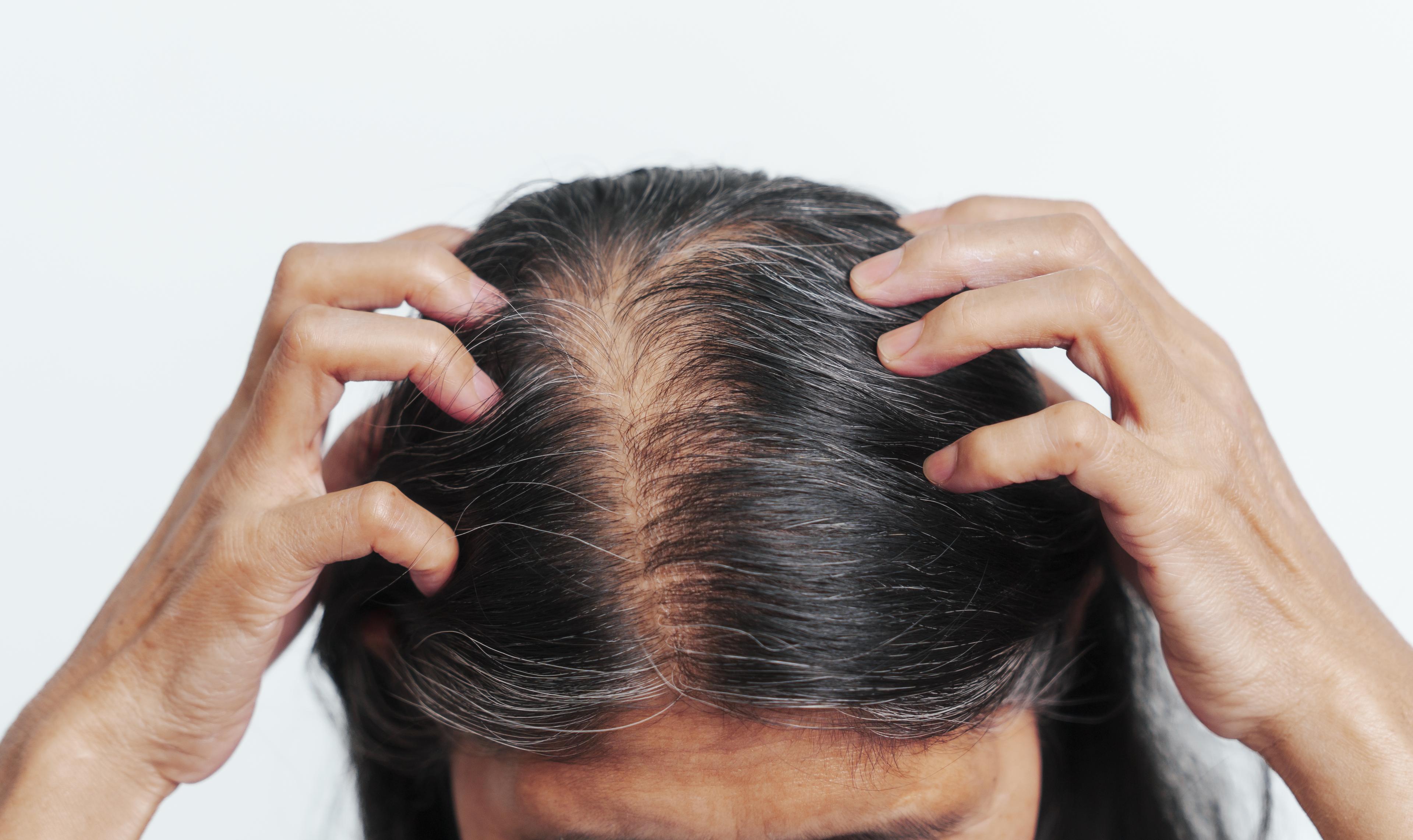 Hair thinning & Increased dryness and frizz - Women in her 50s - Tab & Mobile