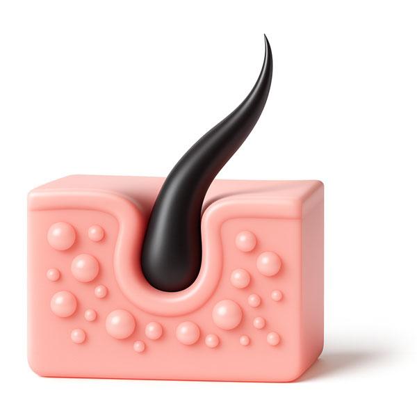 illustration of hair folicle