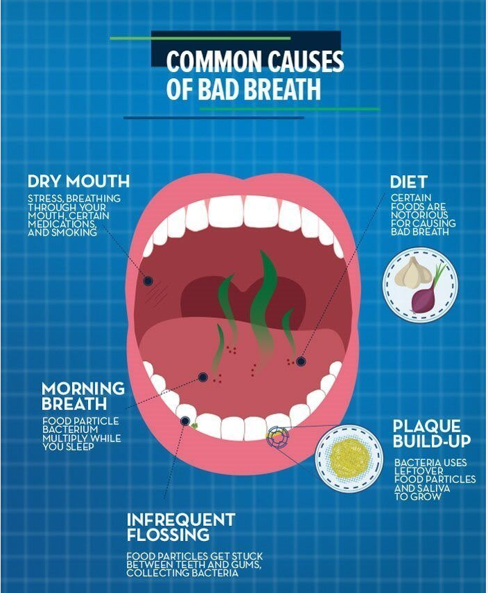 Common causes of bad breathe