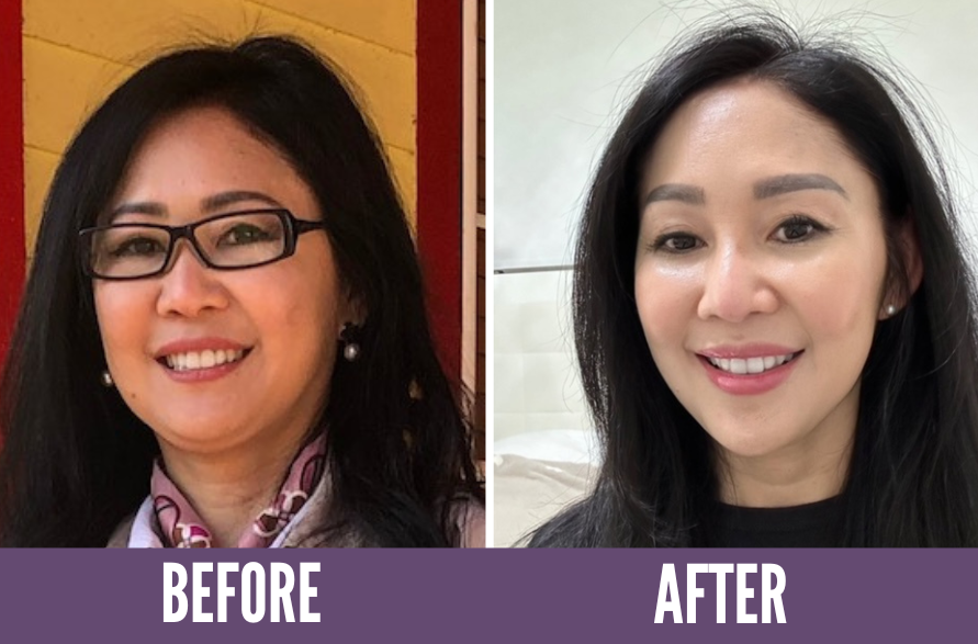 Koko Face Yoga Before/After Results