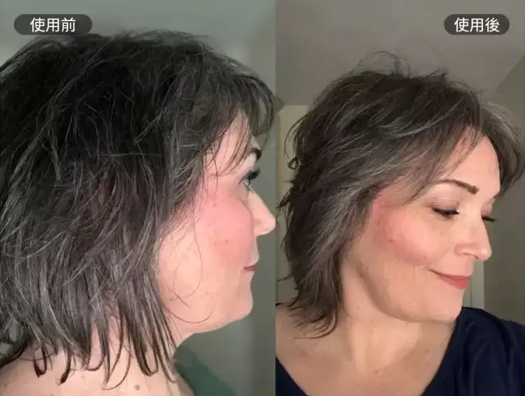 Lisa S - Before & After Review