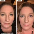 Before and after using Kesaradi Oil - Untouched photo of a verified customer