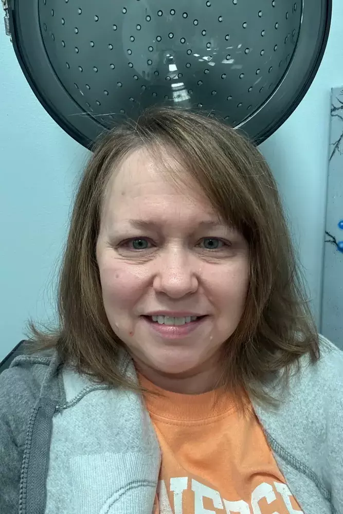 After image of customer 2