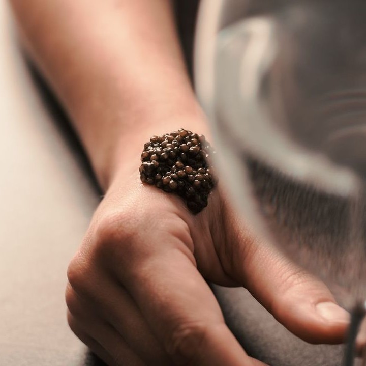 Caviar bump on a woman's hand