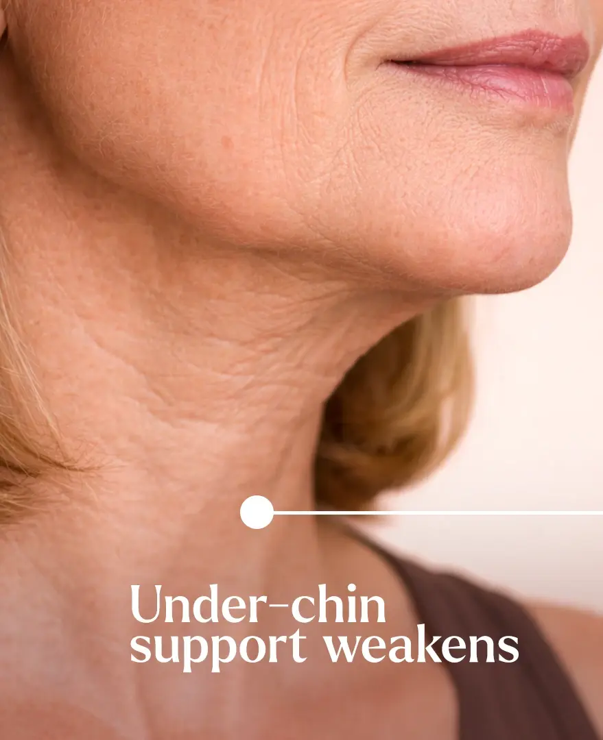 Women showing Under-chin support weakens