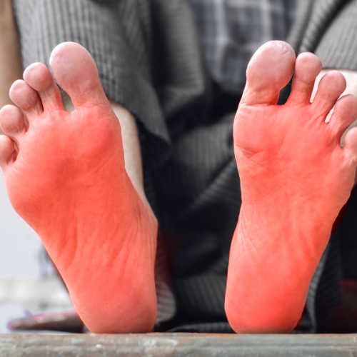 burning sensation on feet