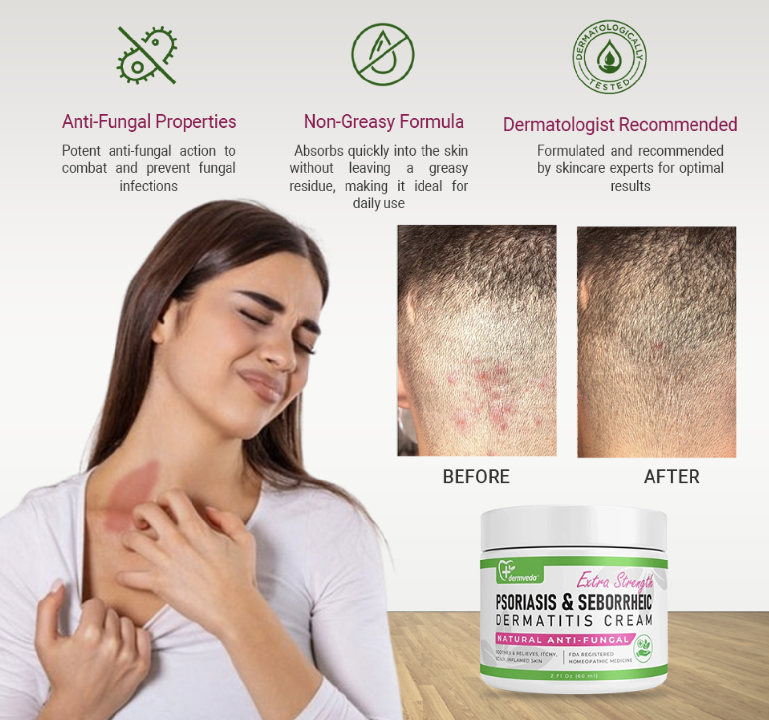 Psoriasis relief before and after