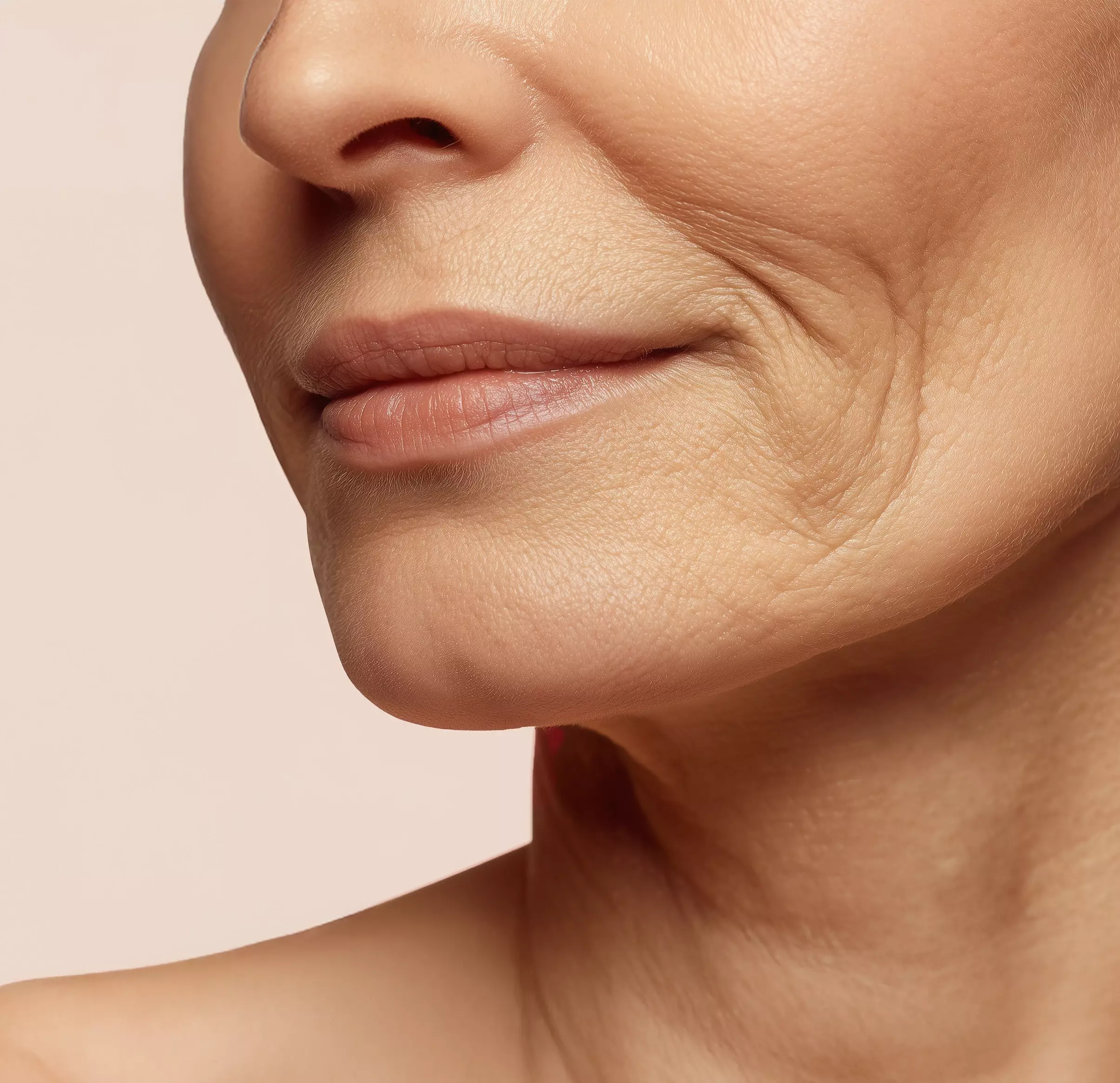 Desert-dry and volume-starved skin