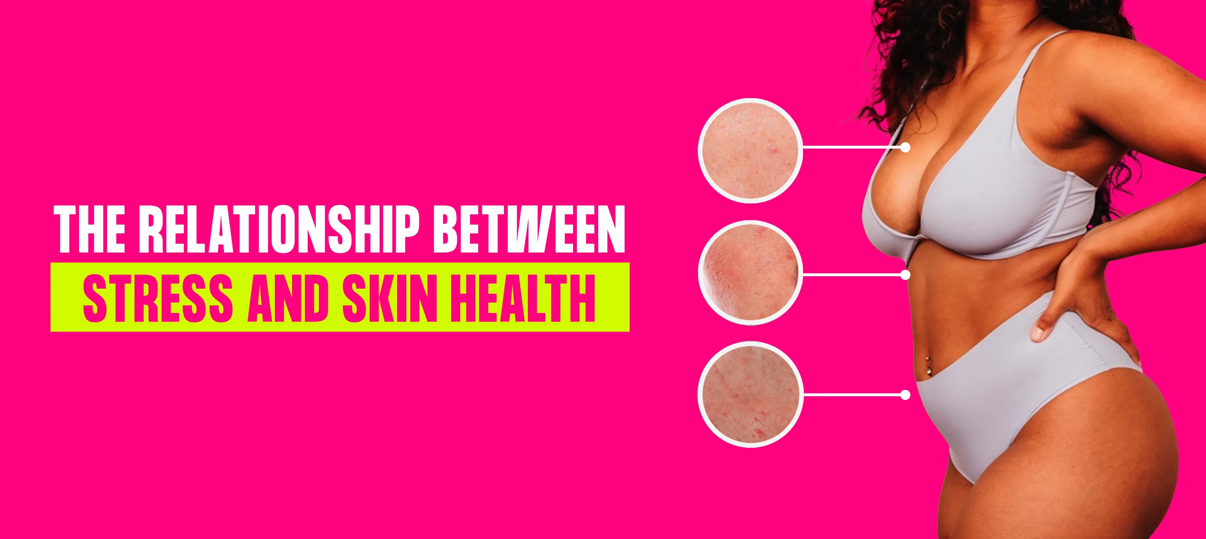 The Relationship Between Stress and Skin Health