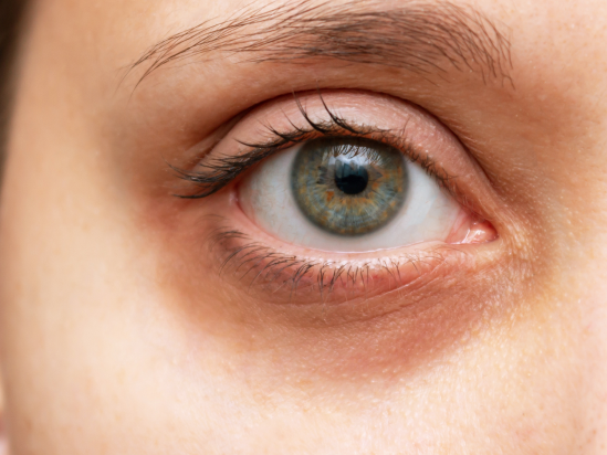 zoomed picture of eyes in early 40s