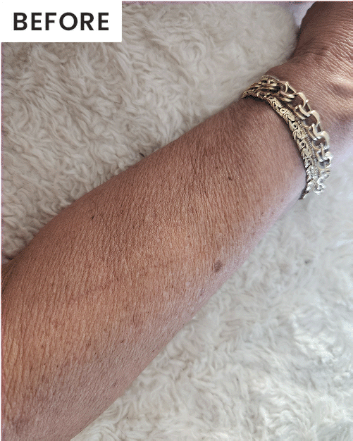 Before After GIF - Review 1