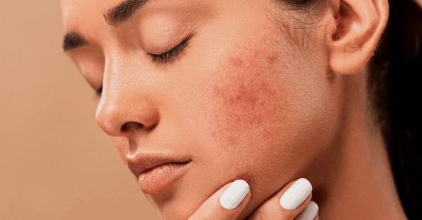 Causes And Solutions For Difficult Skin Conditions