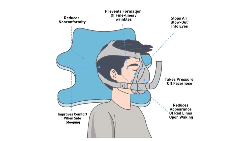 Sleep Apnea and CPAP Therapy