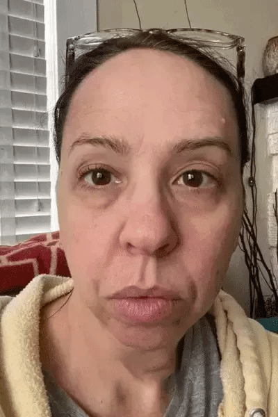 Before After GIF - Review 2