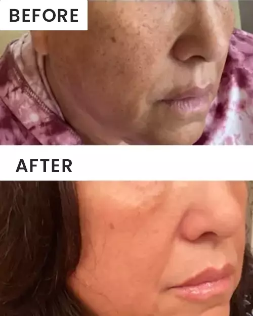 Before and after images of customer 5