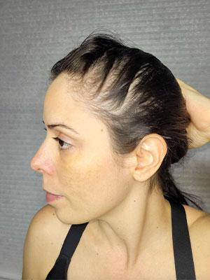lisa hair before