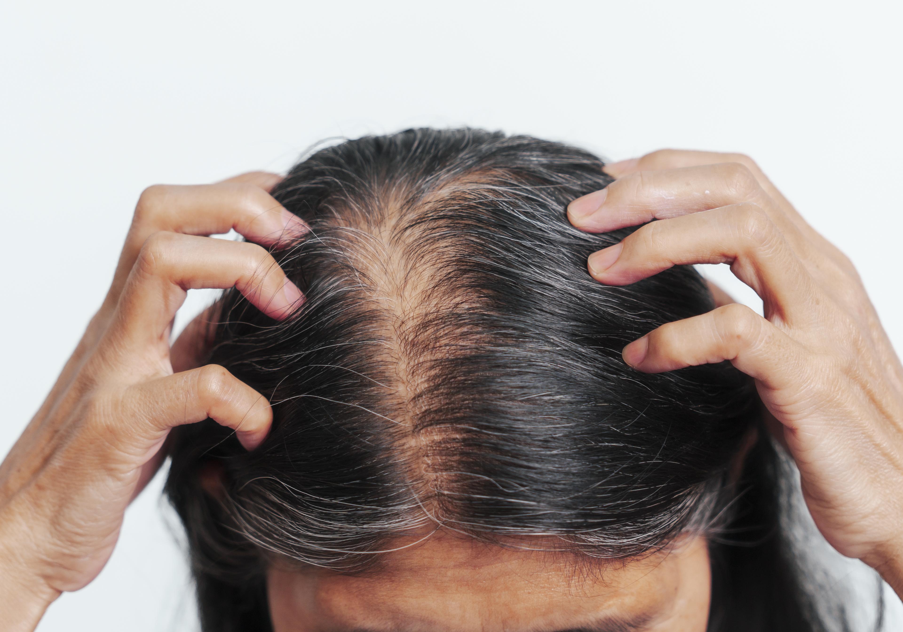 Hair thinning & Increased dryness and frizz - Women in her 50s - Desktop