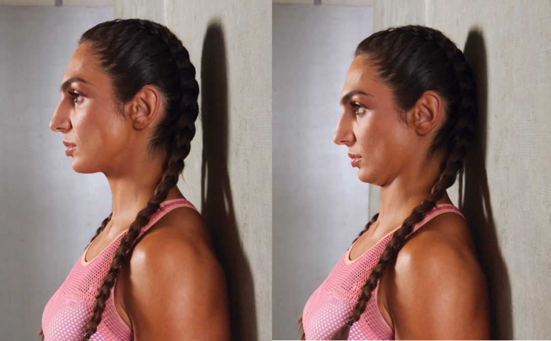 Chin tuck exercise for jawline