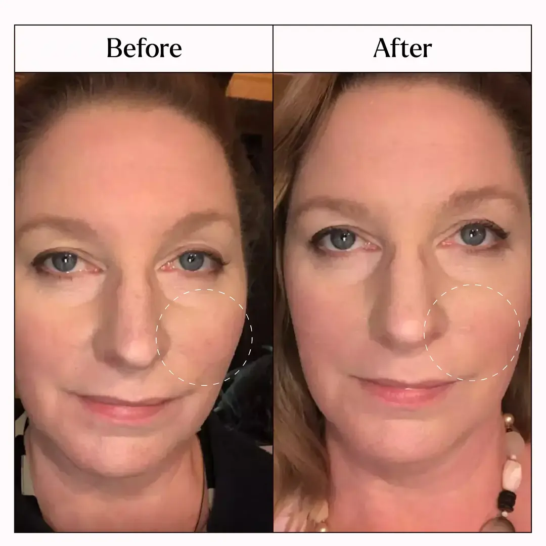 Before and after image of a consumer using the product