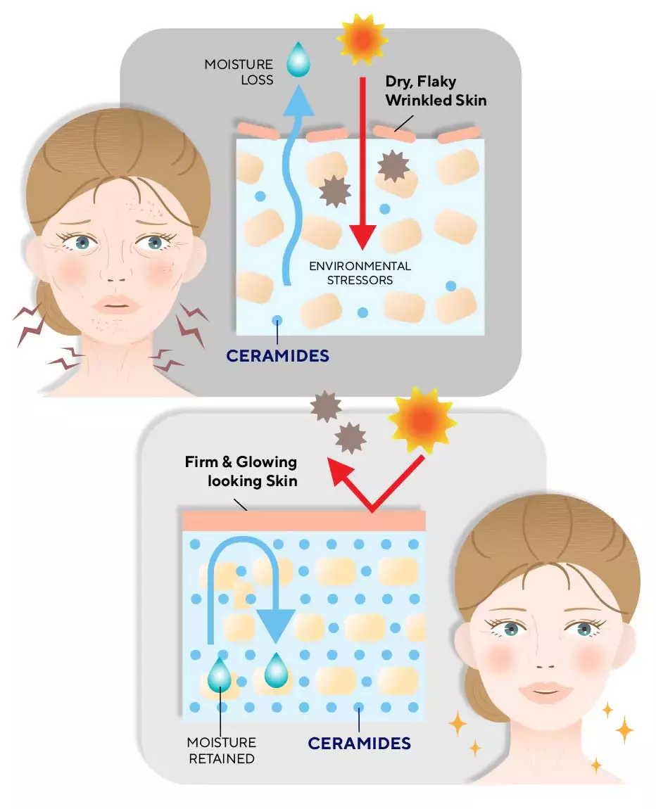 infograph showing role of Ceramides in maintaining the skin barrier