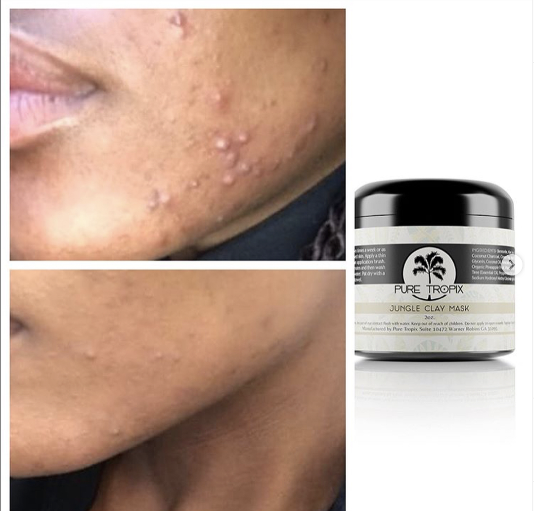 Jungle Clay Mask