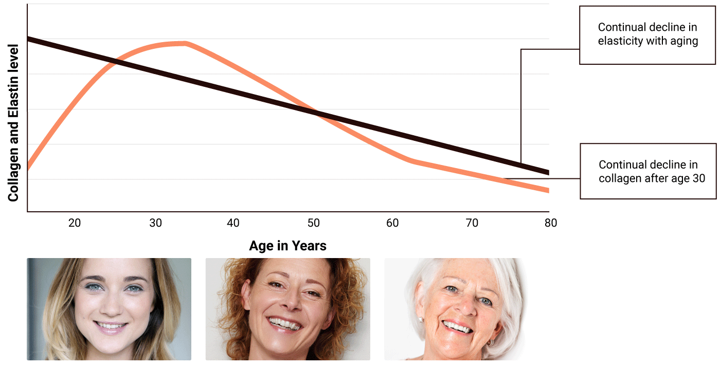 Graph showing decline in elasticity and collagen as we age