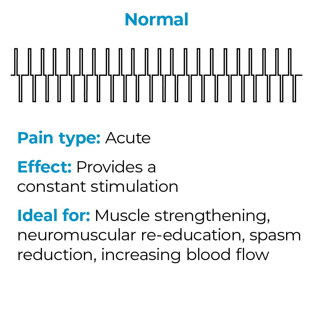 A diagram showing how normal mode works