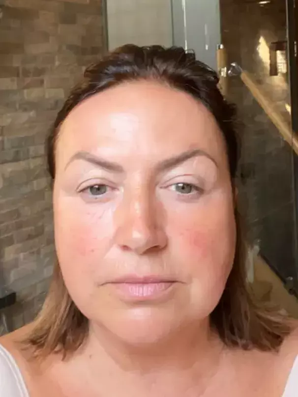 Before image of customer 3