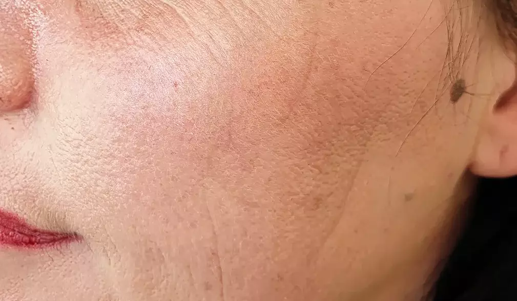Sleep set lines